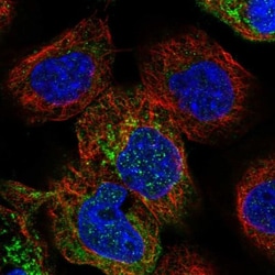 PPOX Antibody, Novus Biologicals 0.1mL; Unlabeled:Antibodies, Polyclonal